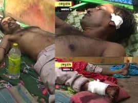 Unrest In Fourth Phase Bombing Thrashing In Nadia Burdwan উত্তপ্ত চতুর্থ দফা:মারে নাক-মুখ ফাটল ভোটারের, কান কেটে পা ভাঙা হল সিপিএম কর্মীর