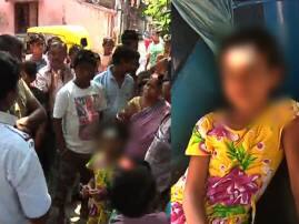 7 Year Old Child Injured In Post Poll Violence In Behala ভোট-সন্ত্রাসে ফের আক্রান্ত শৈশব, লাঠির ঘায়ে মাথা ফাটল ৭ বছরের শিশুর
