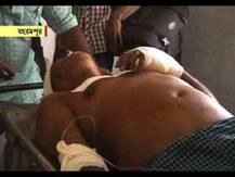 ভোট-পরবর্তী সন্ত্রাসের জের, বহরমপুরে গুলিবিদ্ধ তৃণমূলের জেলা সম্পাদক