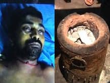 খাবার নিয়ে বচসা, ফুটন্ত ঝোলের কড়াইয়ে হোটেল মালিককে ধাক্কা ক্রেতার, হাসপাতালে মৃত্যু