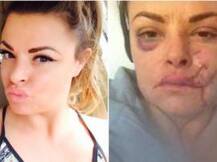 দেখুন: বারে গ্লাস দিয়ে মার, মুখে ৫০ টি সেলাই মডেলের