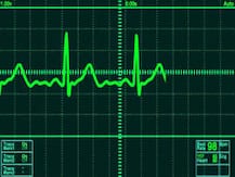 শেষকৃত্যের সময় বেঁচে উঠলেন ‘মৃত’ বৃদ্ধা!