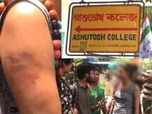 আশুতোষ কলেজে এসএফআই সমর্থক ছাত্রীকে ‘মার’, কাঠগড়ায় টিএমসিপি