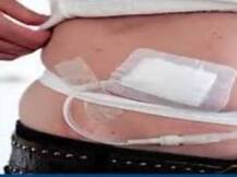 গ্রেফতার কিডনি কিংপিনের ঘনিষ্ঠ সহযোগী