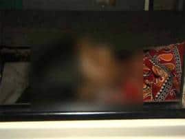 Acid Attack On College Student At West Midnapore পশ্চিম মেদিনীপুরে কলেজ ছাত্রীর উপর অ্যাসিড হামলা, সন্দেহের তির প্রাক্তন প্রেমিকের দিকে