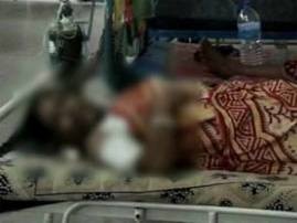 Acid Attack On A Housewife At Chakda In Nadia বিবাহ-বহির্ভূত সম্পর্কে নারাজ গৃহবধূর ওপর অ্যাসিড-হামলা