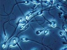 যেতে হবে না ল্যাব, ঘরে বসে স্মার্টফোনেই শুক্রাণু-পরীক্ষা!