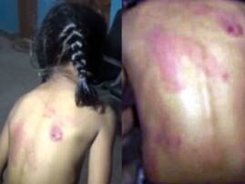 7 Year Old Thrashed By Tuition Teacher For Not Doing Homework হোমওয়ার্ক না করায় দ্বিতীয় শ্রেণীর ছাত্রীকে বেল্ট দিয়ে বেধড়ক মার শিক্ষিকার