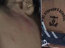 রোল নম্বর ভুল লেখায় 'বেধড়ক মার' শিক্ষিকার, কানে গুরুতর চোট খুদে পড়ুয়ার