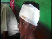 ক্লাস চলাকালে মাথার ওপর খুলে পড়ল সিলিং ফ্যান, রক্তাক্ত পঞ্চম শ্রেণির ছাত্র