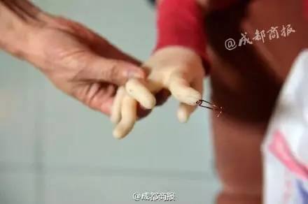 খবরে প্রকাশ, কিছুদিনের মধ্যেই ওই পুতুলের হাত থেকে তার বেরিয়ে আসতে শুরু করে। এখন ওই পুতুলের প্রস্তুতকারী সংস্থার বিরুদ্ধে আদালতের দ্বারস্থ ওই ব্যক্তি। সব ছবি সৌজন্য - ফেসবুক