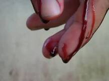 অমানবিক! বিহারে মৃতদেহের গলায় দড়ি বেঁধে টেনে নিয়ে গেল পুলিশ