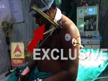 দুর্ঘটনায় শরীরে এফোঁড়-ওফোঁড় বাঁশ, এসএসকেএমে জটিল অস্ত্রোপচার, প্রাণ বাঁচল বাসচালকের