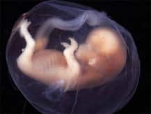 নারী দিবস উদযাপনের আবহেই গুরুগ্রামে মিলল কুকুরে-খাওয়া কন্যাভ্রূণ, মন্দিরে পরিত্যক্ত শিশুকন্যা