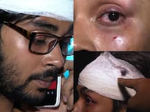 শব্দবাজির প্রতিবাদ, পুলিশের সামনেই মার তরুণী সহ ৪ জনকে