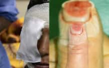 তার মেয়েকে অপহরণ করা হয়েছে, সন্দেহে বোনের চোখ উপড়ে, আঙুল কেটে দিল দাদারা!