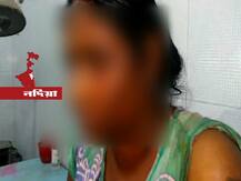 পারিবারিক কলহের জের, নদিয়ায় স্ত্রীকে লক্ষ্য করে অ্যাসিড হামলা স্বামীর