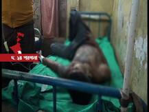 বিবাহ-বহির্ভূত সম্পর্কে বাধা, ঘুমন্ত স্বামীকে পুড়িয়ে মারার চেষ্টা স্ত্রীর