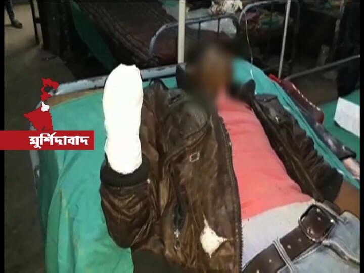 Brother Has Hand Chopped Off For Protesting Humiliation Of Sister Allegedly By Local Youth In Murshidabad বোনকে উত্যক্ত করার প্রতিবাদ, দাদার হাত কেটে নিল দুষ্কৃতী!