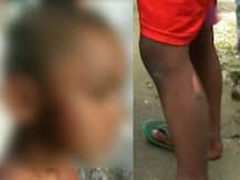 ভাড়াটের পাঁচ বছরের বাচ্চাকে গরম খুন্তির ছ্যাঁকা, ফেরার বাড়িওয়ালা ও তাঁর মেয়ে