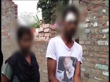 সল্টলেকে মদ-জুয়ার আসর, প্রতিবাদ করায় আক্রান্ত দম্পতি, স্ত্রীকে মার, বাঁচাতে এসে মাথা ফাটল স্বামীর