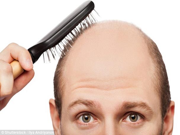 Short Men More Likely To Bald Prematurelystudy বেঁটে, ফর্সা মানুষদের দ্রুত টাক পড়ে যায়:গবেষণা