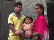 দেখুন: পঞ্জাবের এই আট মাসের শিশুর ওজন ১৭ কেজি!