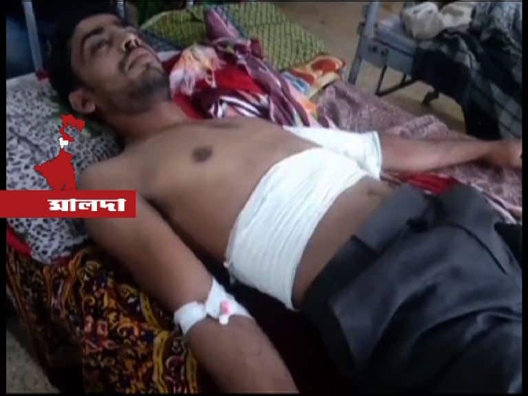 Man Attacked During Quarrel Over Betting On Cricket Match ক্রিকেটে বাজি ধরা নিয়ে বচসা, মালদায় আক্রান্ত যুবক