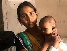 গুজরাতে জন্ম নিল চারপেয়ে শিশু, গ্রামে একঘরে পরিবার, জটিল অস্ত্রোপচারে বাদ পড়ল দুটি পা