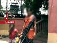 খাবার চাইলে গরম লোহার ছ্যাঁকা, অ্যাসিডে পুড়িয়ে দেওয়া হয় দু’হাত! মেয়ে জন্ম দেওয়ায় গৃহবধূকে অমানবিক অত্যাচার শ্বশুরবাড়ির