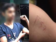 ব্লু হোয়েল গেমের ‘শিকার’ গড়বেতার একাদশ শ্রেণীর পড়ুয়া, হাত কেটে লিখল ‘এফ ৫৭’