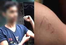 ফেসবুকে আলাপ হওয়া বান্ধবীর কথায় হাত কেটে, সহানুভূতি কুড়োতে ব্লু হোয়েলের গল্প ফাঁদে গড়বেতার ছাত্র