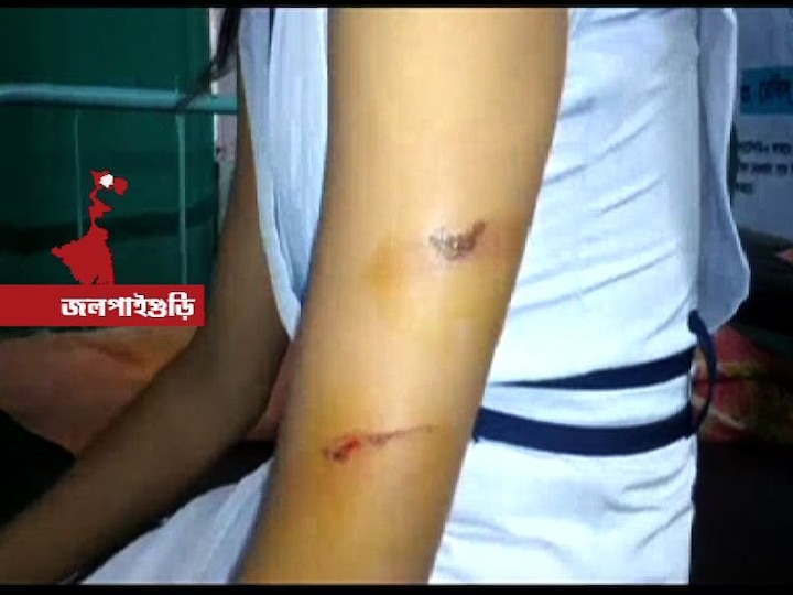 Girl Student Allegedly Beaten By Teacher For Failing To Submit Answer Sheet On Time পরীক্ষার খাতা দিতে দেরি, শিক্ষকের ‘মারে’ রক্তাক্ত ছাত্রী