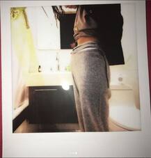 সম্প্রতিই কিডনি ট্রান্সপ্ল্যান্ট করিয়েছেন এই গায়িকা, হাসপাতালের বিছানা থেকে ডোনারের সঙ্গে তাঁর ছবি শেয়ার করলেন তিনি