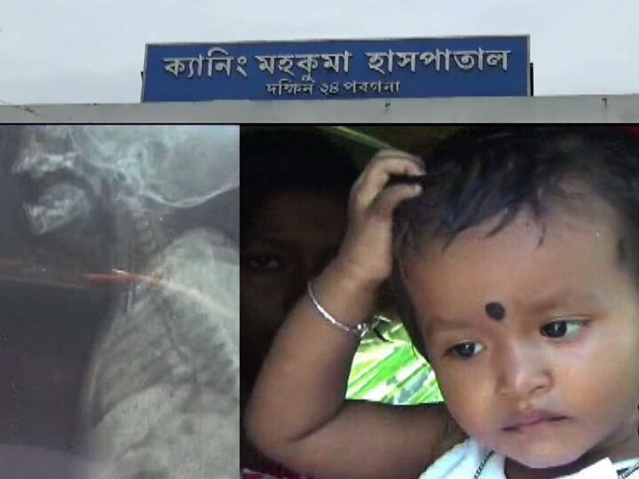 Child Coin Incident Again Raised Question About The Service Provided By Govt Hospital কয়েন গিলে ফেলেছিল মেয়ে, এক্স রে করাতে গিয়ে মা-বাবাকে ছুটতে হল একাধিক হাসপাতালে, প্রশ্নের মুখে পরিষেবা