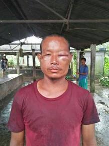 পাঁচজনের সামনে \'অস্বস্তিকর\' প্রশ্ন, সওয়ালকারীকে বেধড়ক ঠেঙিয়ে শিক্ষা দিলেন বিধায়ক