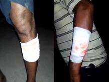 মালদায় হোটেলে মদ না পেয়ে রাঁধুনিকে ধারালো অস্ত্রের কোপ, অভিযুক্ত মত্ত যুবকরা