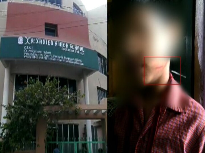 Teacher allegedly injured class two student in Durgapur with pen দুর্গাপুরে শিক্ষিকার ‘কলমের খোঁচা’, রক্তাক্ত খুদে