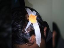 কলকাতা বিশ্ববিদ্যালয়ের হস্টেলেই ‍র‍্যাগিং, মুখ খুললেন নির্যাতিত ছাত্র, ‘এমন মেরেছিল, মরেই যেতাম’