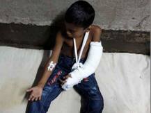 ভাঙা হাতের অস্ত্রোপচার করতে গিয়ে তৃতীয় শ্রেণির পড়ুয়ার মৃত্যু মেডিক্যাল কলেজ হাসপাতালে