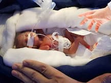 মাত্র ৪০০ গ্রাম ওজনের শিশুকন্যা জন্মালো উদয়পুরে, সুস্থ আছে সে