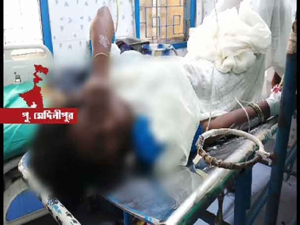 Haldia:Woman burnt, police demand she tries to commit suicide, family claims its a murder attempt চুরির অভিযোগ: থানায় মহিলার গায়ে আগুন, পুলিশের দাবি আত্মহত্যার চেষ্টা, পুড়িয়ে মারতে চেয়েছিল, পাল্টা পরিবার