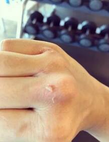 জিমে চোট পেলেন বলিউড অভিনেত্রী নেহা শর্মা