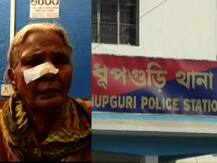 ৮৫ বছরের বৃদ্ধা মাকে মেরে রক্ত ঝরালো ছেলে ও বউমা