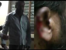 দেগঙ্গায় ছাগল ঘাস খাওয়ায় প্রতিবেশীর কান কামড়ে ছিঁড়ে নেওয়ার অভিযোগ, গ্রেফতার ২