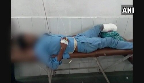 Two doctors suspended after accident victim’s amputated leg used as pillow at Jhansi hospital বালিশের বদলে কাটা পা: সাসপেন্ড ২ চিকিৎসক