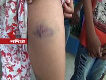 সন্দেহ, কলা চুরি করেছে, নদিয়ায় নির্মম অত্যাচারের শিকার ৫ নাবালক