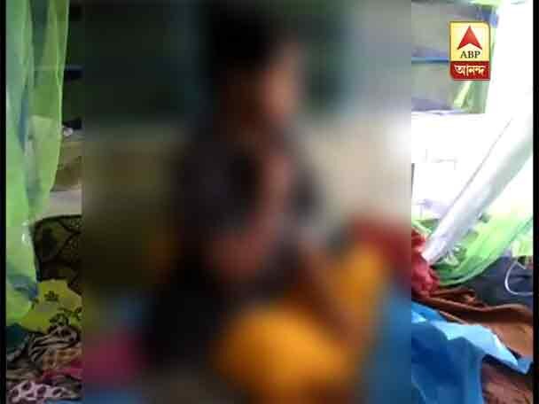 man throws acid on wife's sister বিয়ের প্রস্তাবে রাজি না হওয়ায় ঘুমন্ত শ্যালিকার ওপর অ্যাসিড হামলা জামাইবাবুর