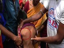 পঞ্চায়েত ভোটে স্কুল না যাওয়ায় ৮ বছরের শিশুকে বেধড়ক মার,অভিযুক্ত প্রধান শিক্ষিকা