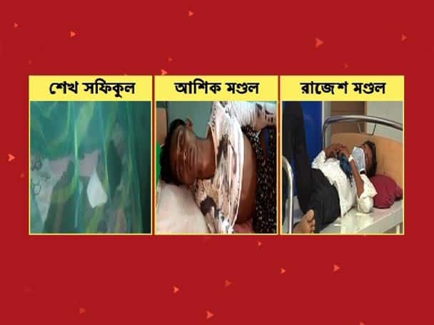 রাজ্যে ক্রমশ বাড়ছে নিপা আতঙ্ক: অজানা জ্বরে আক্রান্ত হয়ে হাসপাতালে ভর্তি আরও ১ Nipah Fear:In state another suspected Nipah victim admitted at Beleghata hospital রাজ্যে ক্রমশ বাড়ছে নিপা আতঙ্ক: অজানা জ্বরে আক্রান্ত হয়ে হাসপাতালে ভর্তি আরও ১